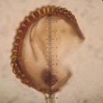Asplenium trichomanes ssp. quadrivalens - Braunstieliger Streifenfarn