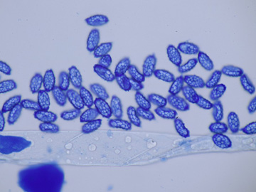Melastiza cornubiensis