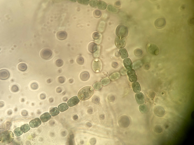 Anabaena azollae