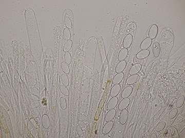 Cheilymenia vitellina