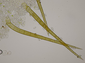Cheilymenia vitellina