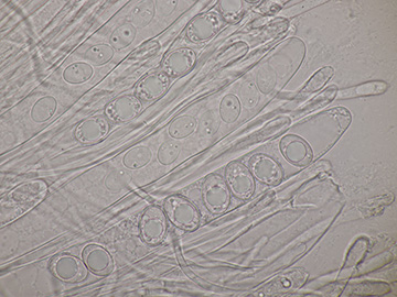 Trichophaea woolhopeia